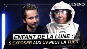Moon Child: Exposure to UV rays could kill her